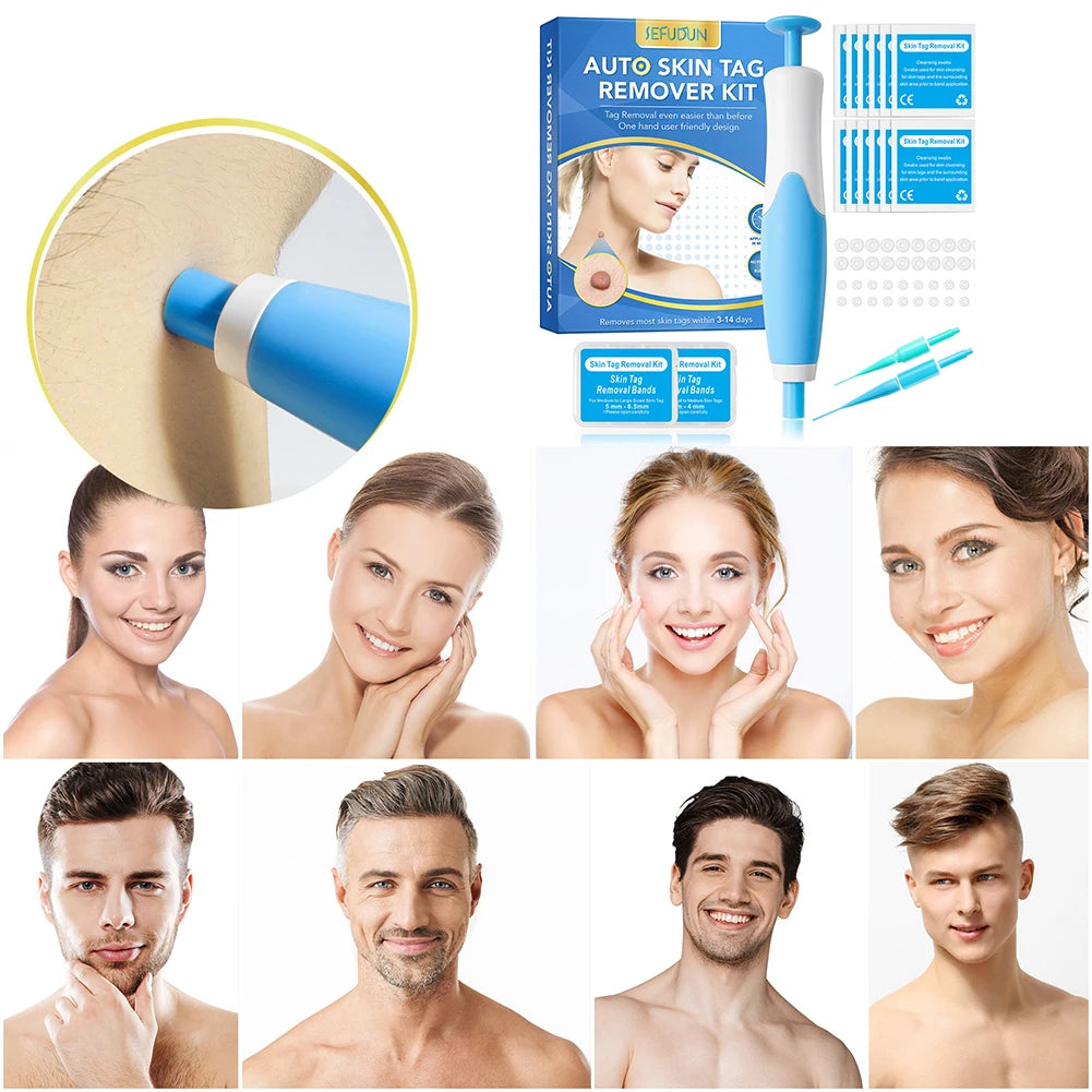 2 IN 1 Auto Micro Skin Tag Remover - Standard And Micro Skin Tag Removal Kit - Mole Wart Remover - Face Care Beauty Tool